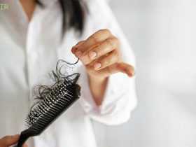 ۱۱ روش برای جلوگیری از ریزش مو - حرفه ای